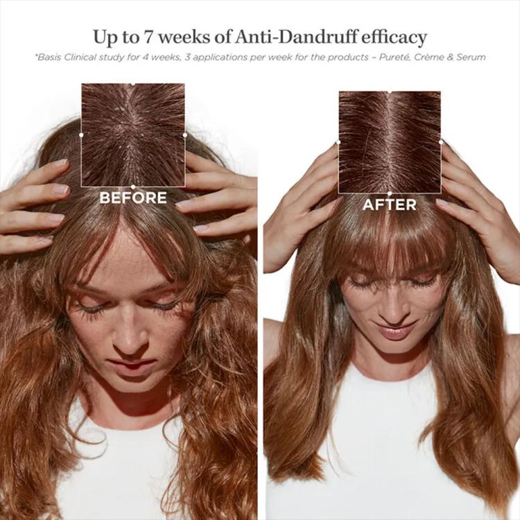 Kerastase Symbiose Bain Pureté Anti-Dandruff Shampoo - 250 ml