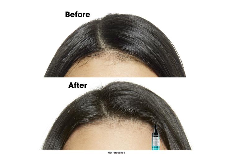 سيروم L’Oréal Professionnel Scalp Advanced لمكافحة الدهون - 90 مل