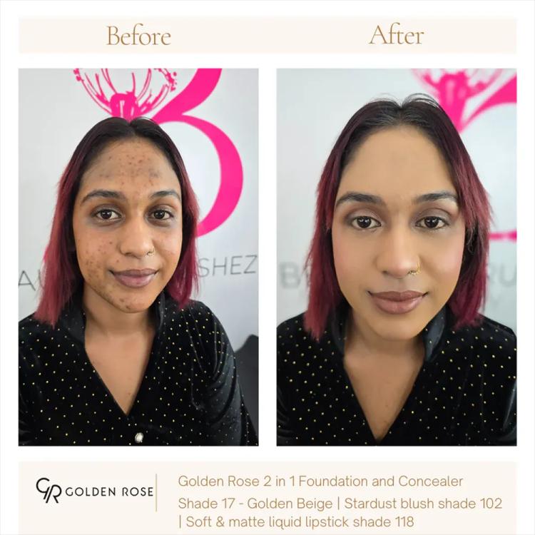 Golden Rose Total Cover 2 in 1 Foundation & Concealer SPF 15 - 17 Golden Beige (30 ml)