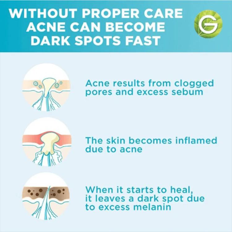 Garnier Skinactive Fast Clear Booster Serum with Salicylic Acid - 15 ml