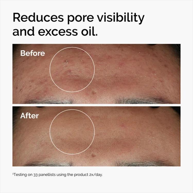 The Ordinary Niacinamide 10% + Zinc 1% Serum - 120 ml