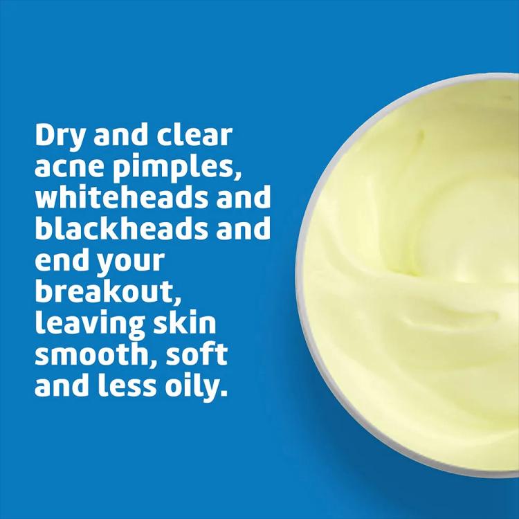 De La Cruz Acne Treatment Ointment with 10% Sulfur Maximum Strength - 73.7 g
